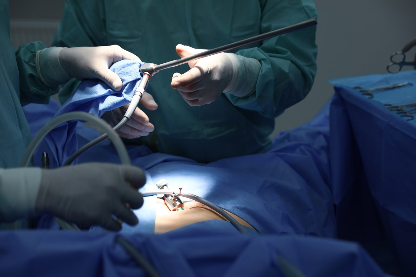 Medical Team Performing Surgery in Operating Room, Closeup